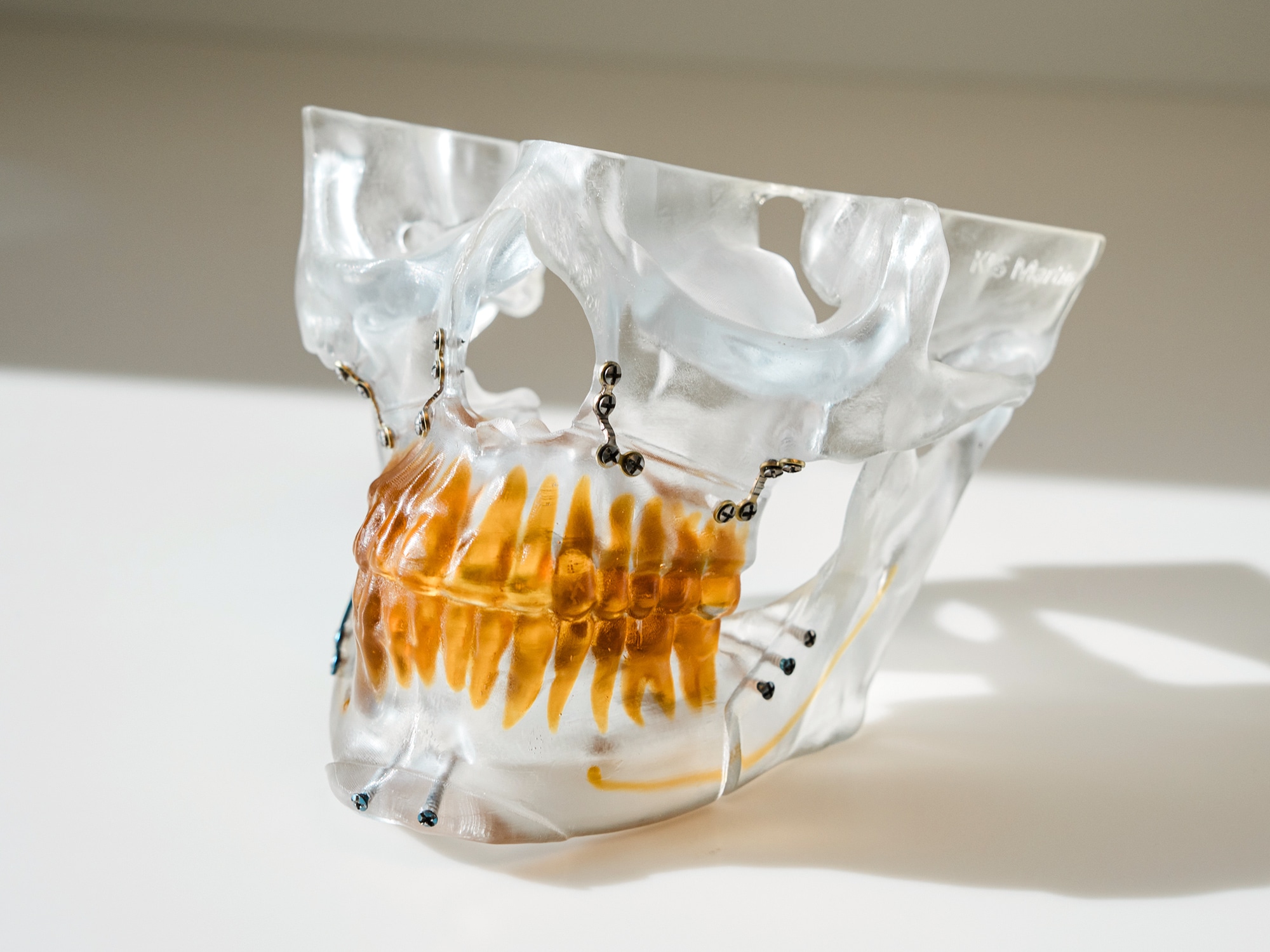 A transparent anatomical model of a skull with visible orange teeth, metal fasteners, displayed on a white surface under natural light.