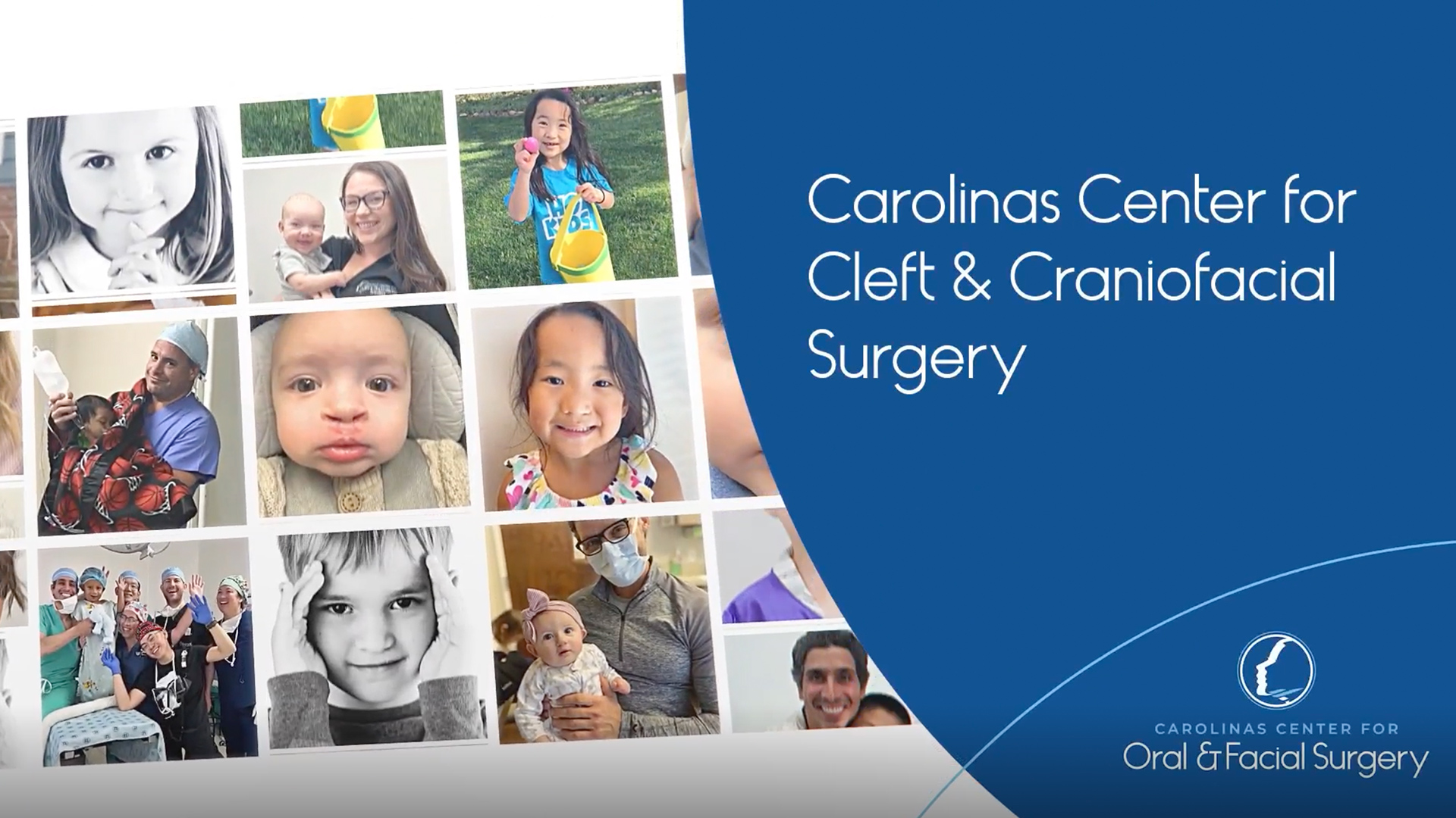 Carolinas Center for Cleft & Craniofacial Surgery Vide Overview