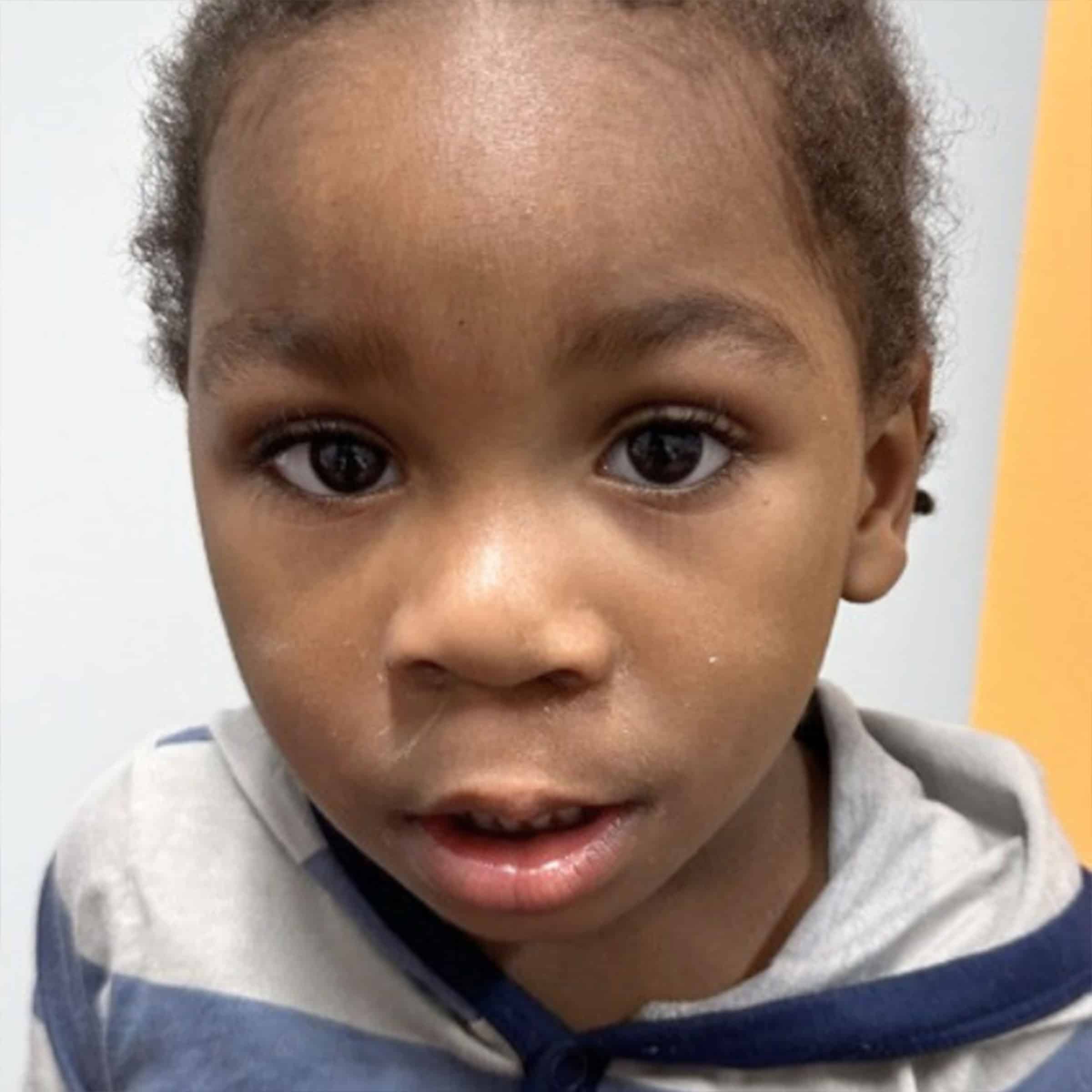 A child with a curious expression looks directly at the camera, wearing a striped shirt, set against a neutral indoor background.