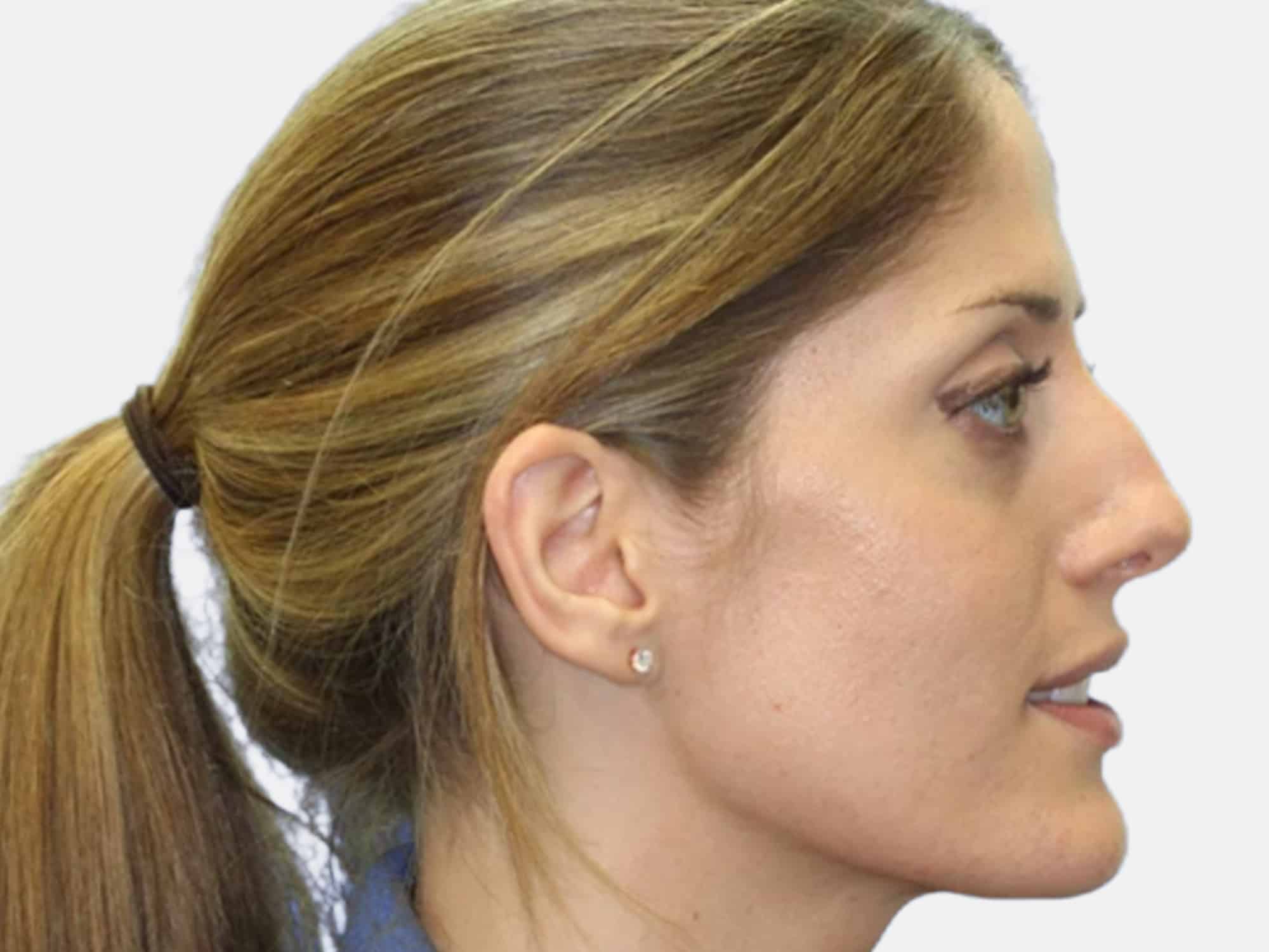 A profile view of a person with a ponytail, side view emphasizes facial features, set against a plain white background.