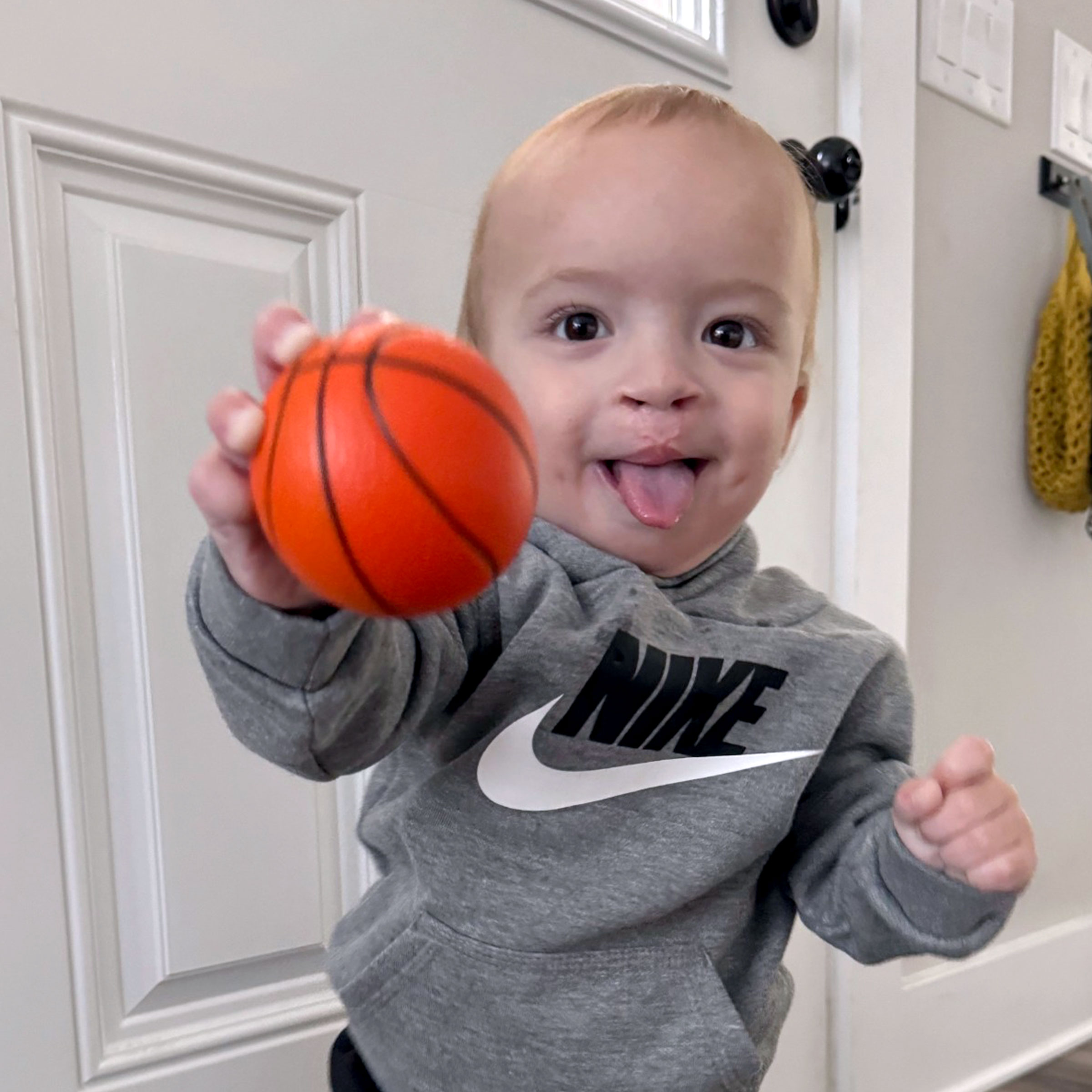 Cleft & Craniofacial Patient Transformation - After