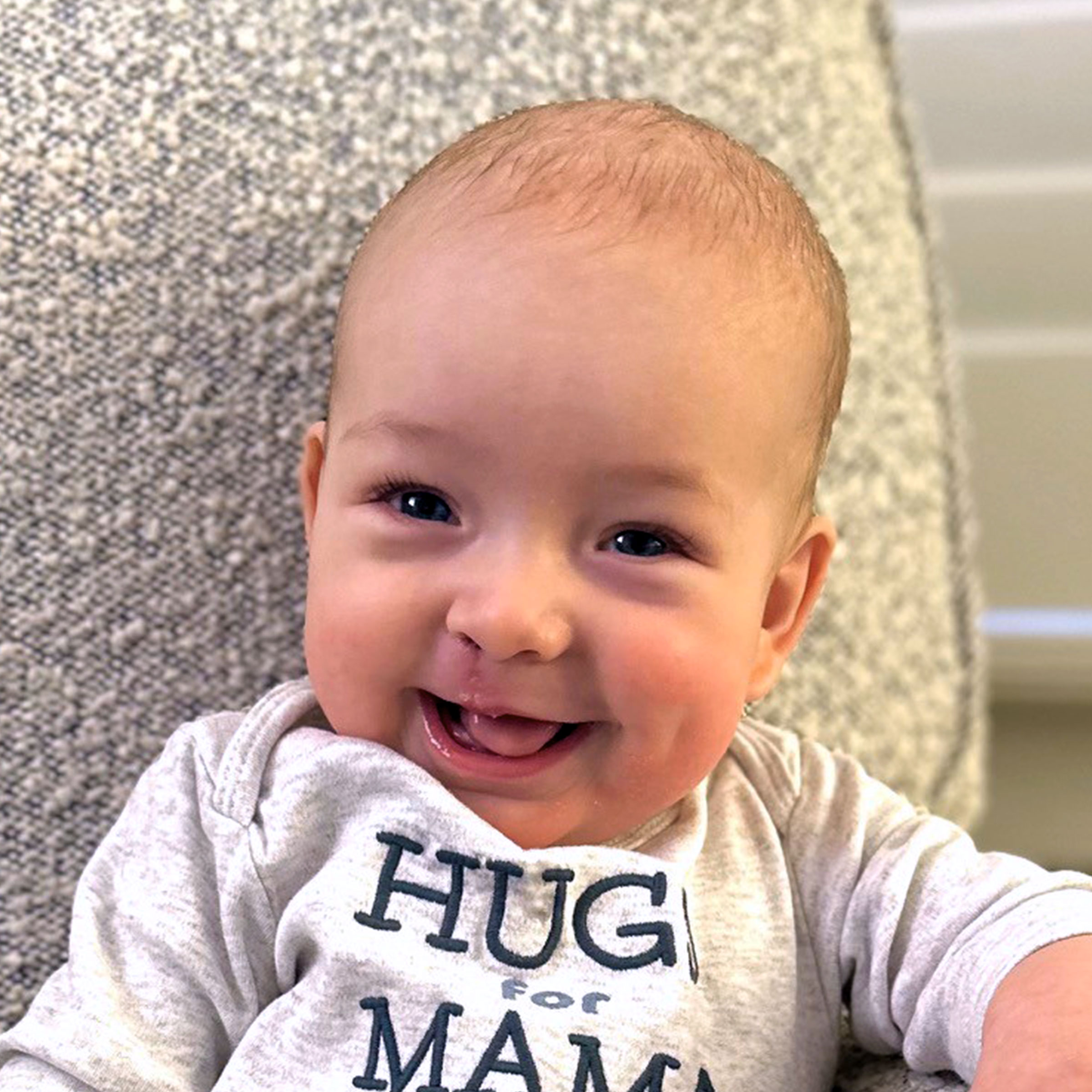 Cleft & Craniofacial Patient Transformation - After