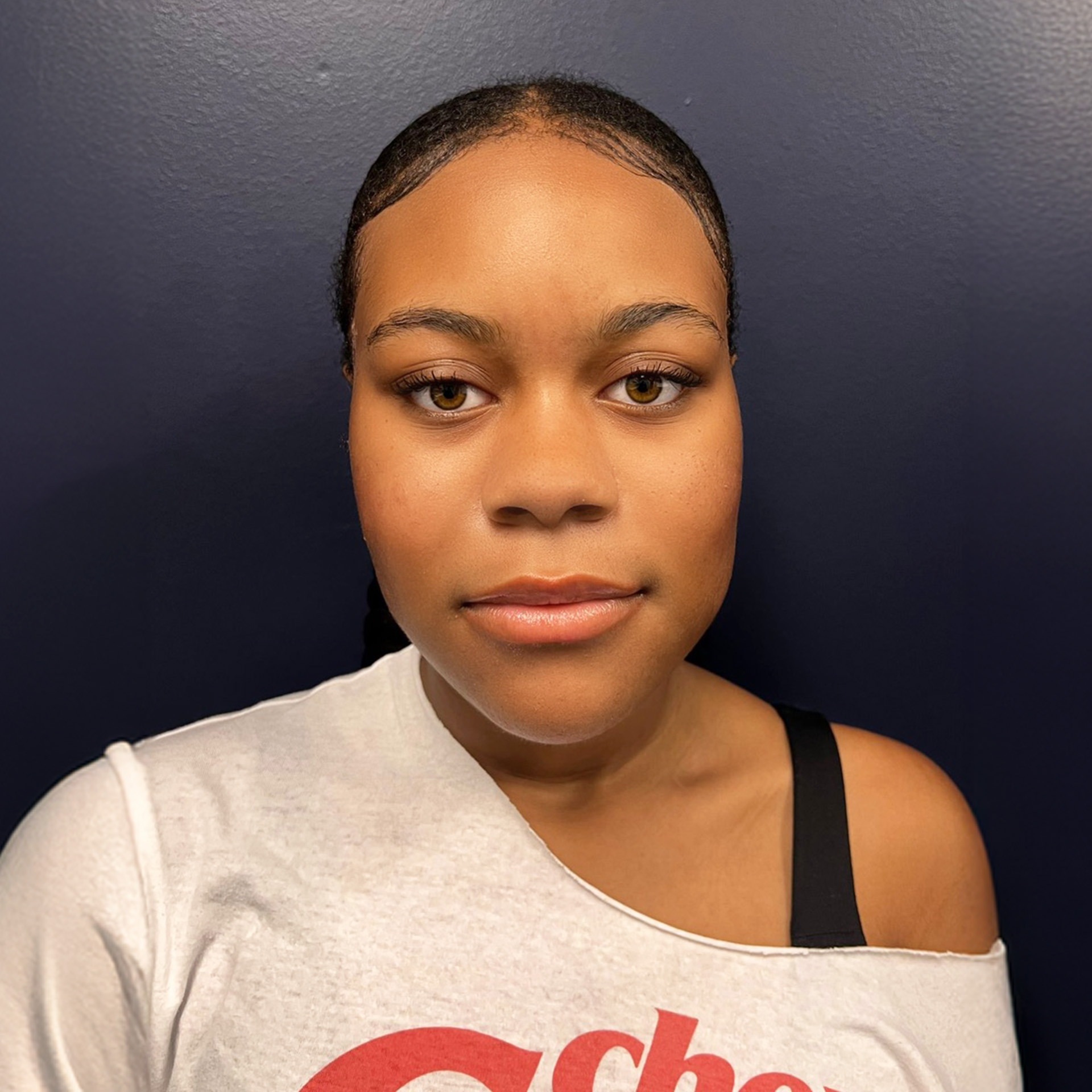 Jaw Surgery After: Dr. Roger Moreira - CCOFS - Raleigh, NC